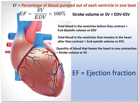 how to assess ejection fraction